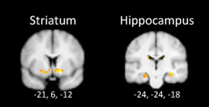 mri